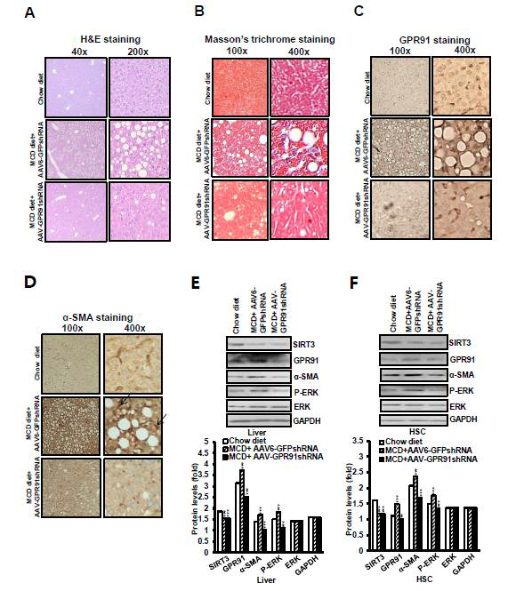 MCD diet fed mice에서의 AAV-GPR91 sh RNA를 투여시, GPR91 and α SMA 발현