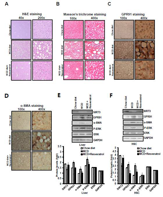 MCD diet fed mice에서의 Resveratrol을 투여시, GPR91 and α SMA 발현