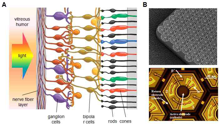 (A) 인체 망막을 구성하고 있는 여러 종류의 세포들 (B) top-down 방식으로 제작된 마이크론 크기의 광검출기 배열의 인공 망막 구조