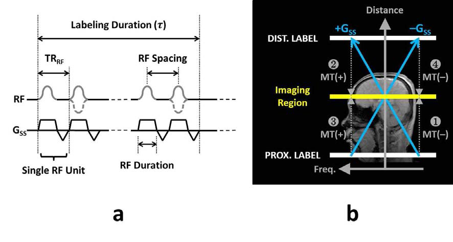 새로운 관류영상 기법 모식도. a. Pulse sequence diagram. b. 촬영순서. Proximal 촬영과 Distal 촬영이 각각 labeling scan과 control scan으로 적용됨