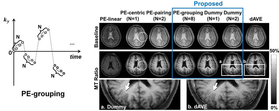 위상부호화 순서를 조정하는 scheme과 결과 그림. Proposed는 제안하는 위상부호화 와 dummy 위상부호화 수를 다르게 조정한 후 complex sum을 함으로써 와전류에 의한 artifact를 줄인 결과 영상. 기존의 pairing보다 artifact correction 결과는 더 좋고, 또 다른 기 존의 double averaging(dAVE)에 비해 자화전이 영상의 해상도가 훨씬 더 높게 보임