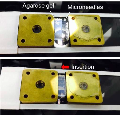 마이크로바늘의 팽윤성을 관 찰하기 위한 실험방법