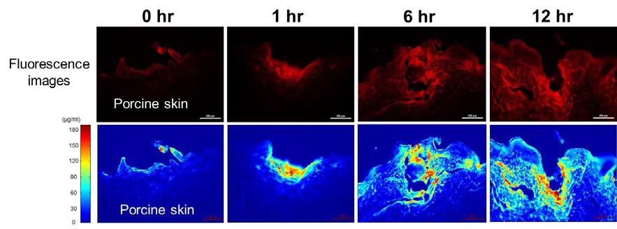 돼지 피부에서 시간에 따른 model drug의 방출 변화