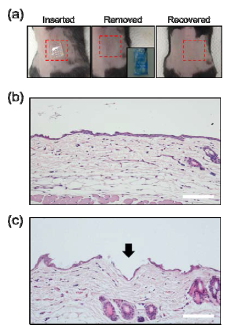 (a) 마이크로바늘 적용에 따른 피부 표면 사진, (b) 마이크로바늘을 적용 하지 않은 피부 조직, (c) 마이크로바늘을 적용한 피부 조직