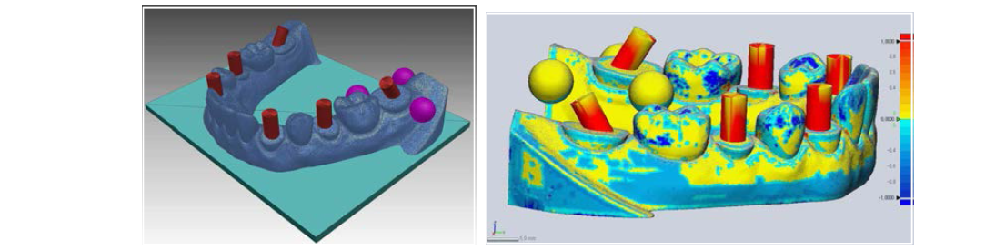 전악 인상채득시 발생할 수 있는 구강스캐너의 스캔오류를 분석할 수 있는 레퍼런스 팬텀 디자인