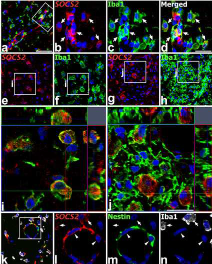 The induction of SOCS2 mRNA in brain macrophages in the infarct area of the ischemic injury on days 3 (a–f, i, and k–n) and 7 (g, h, and j) after reperfusion. (a–d) Double labeling for SOCS2 mRNA and Iba1 showing strong SOCS2 expression in amoeboid brain macrophages (arrows in b–d), which were frequently localized close to blood vessels.