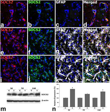 The overlapping expression of SOCS2 mRNA and protein in the infarct (a–d) and peri-infarct areas (e–l) at days 3 (a–h) and 7 (i–l) after focal cerebral ischemia.