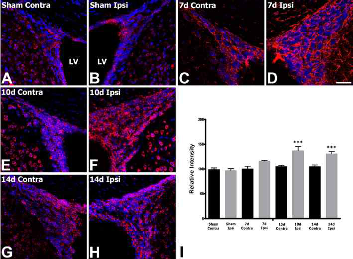 Changes in SOCS2 mRNA expression in the dorsolateral subventricular zone (SVZ) of the lateral ventricle (LV) after focal cerebral ischemia.