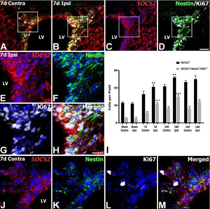 Numbers of SOCS2-expressing cells in the subventricular zone (SVZ) of the lateral ventricle (LV) after focal cerebral ischemia.