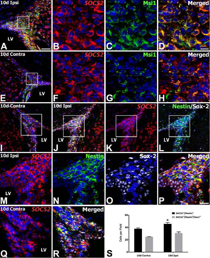 Characterization of SOCS2-expressing SVZ cells on day 10 after reperfusion. (A–H) Double-labeling of SOCS2 mRNA and the neural stem cell marker Musashi1 (Msi1) showing that almost all SOCS2-expressing cells were colabeled with Musashi1.