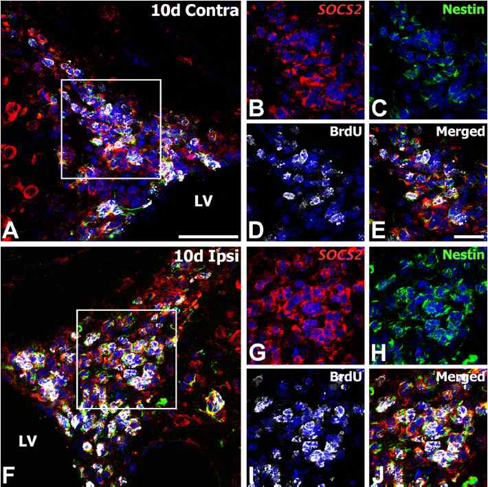 SOCS2 mRNA expression in newly generated neural stem/progenitor cells in the subventricular zone (SVZ) of the lateral ventricle (LV) at 10 days after reperfusion.