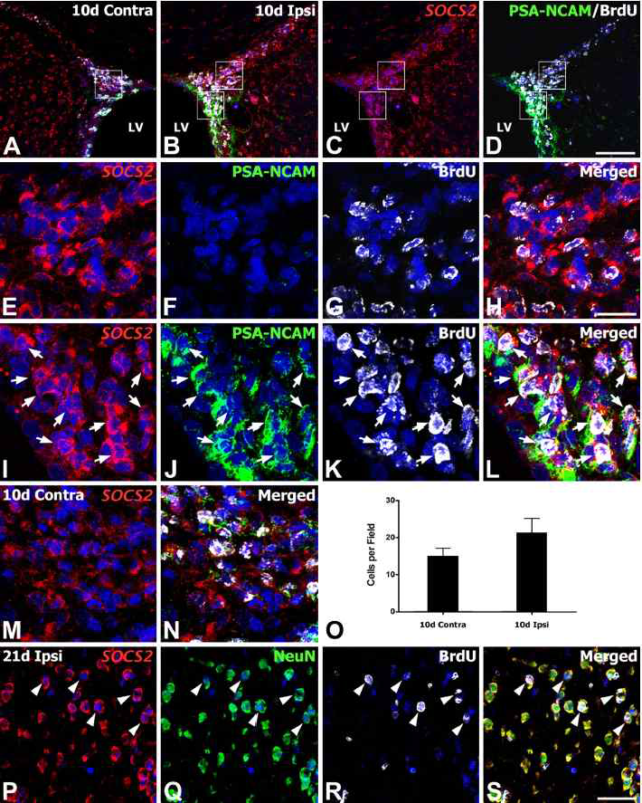 SOCS2 mRNA expression in newly generated immature neurons in the subventricular zone (SVZ) or in mature neurons in the striatum regions at 10 days after reperfusion.