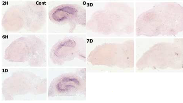 Temporal changes of SOCS2 expression in organotypic hippocampal slice cultures under control and OGD conditions.