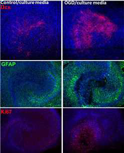 Contol과 OGD 시행 1d 후 DG 에서 신경세포 생성 관련 marker들의 발현