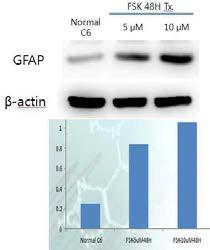 Forskolin (FSK)-induced differentiation of C6 glioma cells.