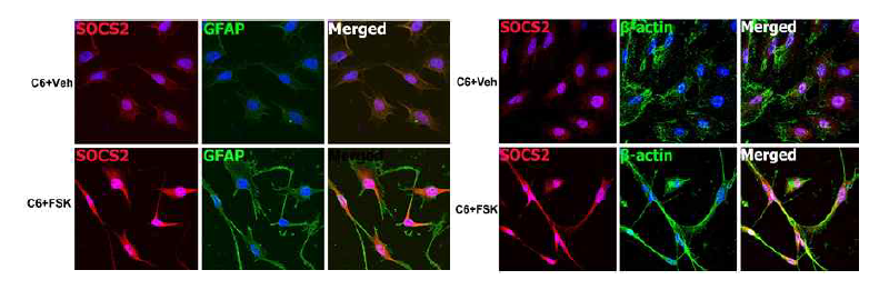 Forskolin (FSK)-induced differentiation of C6 glioma cells. Morphological transformation and SOCS2/GFAP and SOCS2/β-actin immunocytochemical staining.