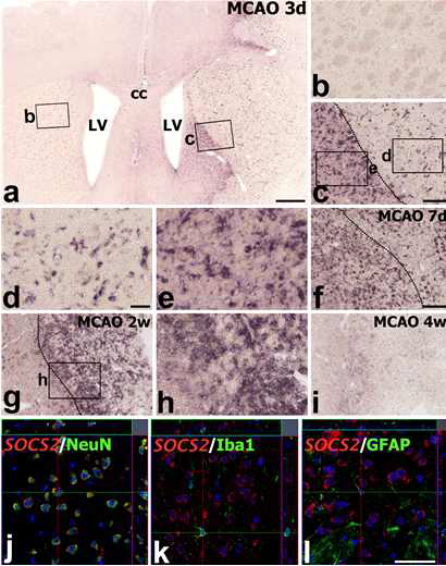 Temporal expression of SOCS2 mRNA after focal cerebral ischemia.