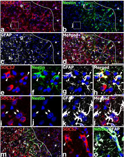 Characterization of SOCS2-expressing cells in the peri-infarct region of the ischemic injury at days 3 (a–l) and 7 (m–o) after reperfusion.