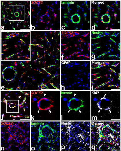 Characterization of SOCS2-expressing cells in the infarct area of the ischemic injury at days 3 (a–m) and 7 (n–q) after focal cerebral ischemia.