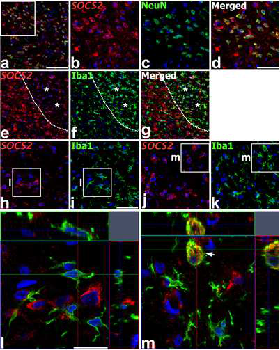 Localization of SOCS2 mRNA in relation to neuronal or microglial markers in the peri-infarct region of the ischemic injury at days 3 (a–i and l) and 7 (j, k, and m) after reperfusion.