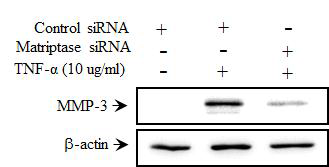 PDL 세포에서 matriptase억제시 MMP 발현 양샹 확 인.