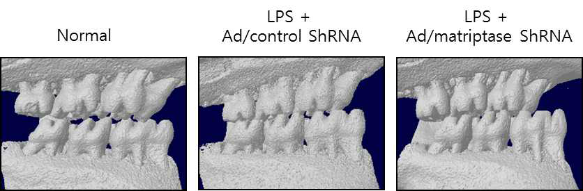 동물 모델에서 matiptase 발현 조절에 따른 치아조직 손상 효과 확인.