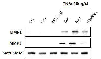 Gingivial Fobroblast에서 matriptase억제시 MMP 발현 양상 확인.