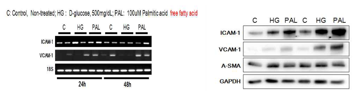 정상 HFLS 세포에 고혈당, palmitic acid 처리 후 24시간, 48시간 후 ICAM-1 발현