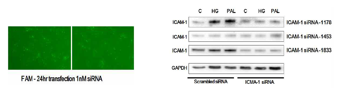 정상 HFLS 세포에 ICAM-1 siRNA tranfection 후 고혈당, palmitic acid 처리 24시간 후 ICAM-1 발현