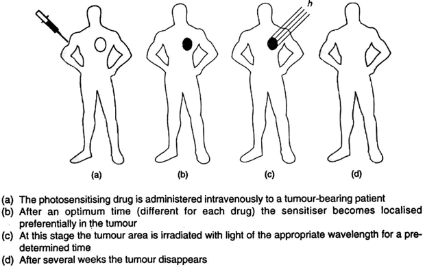 Treatment of PDT into the body of patient