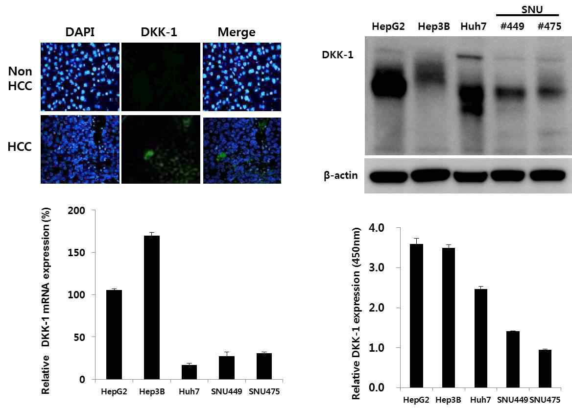 Expression of DKK-1 in HCC cell lines