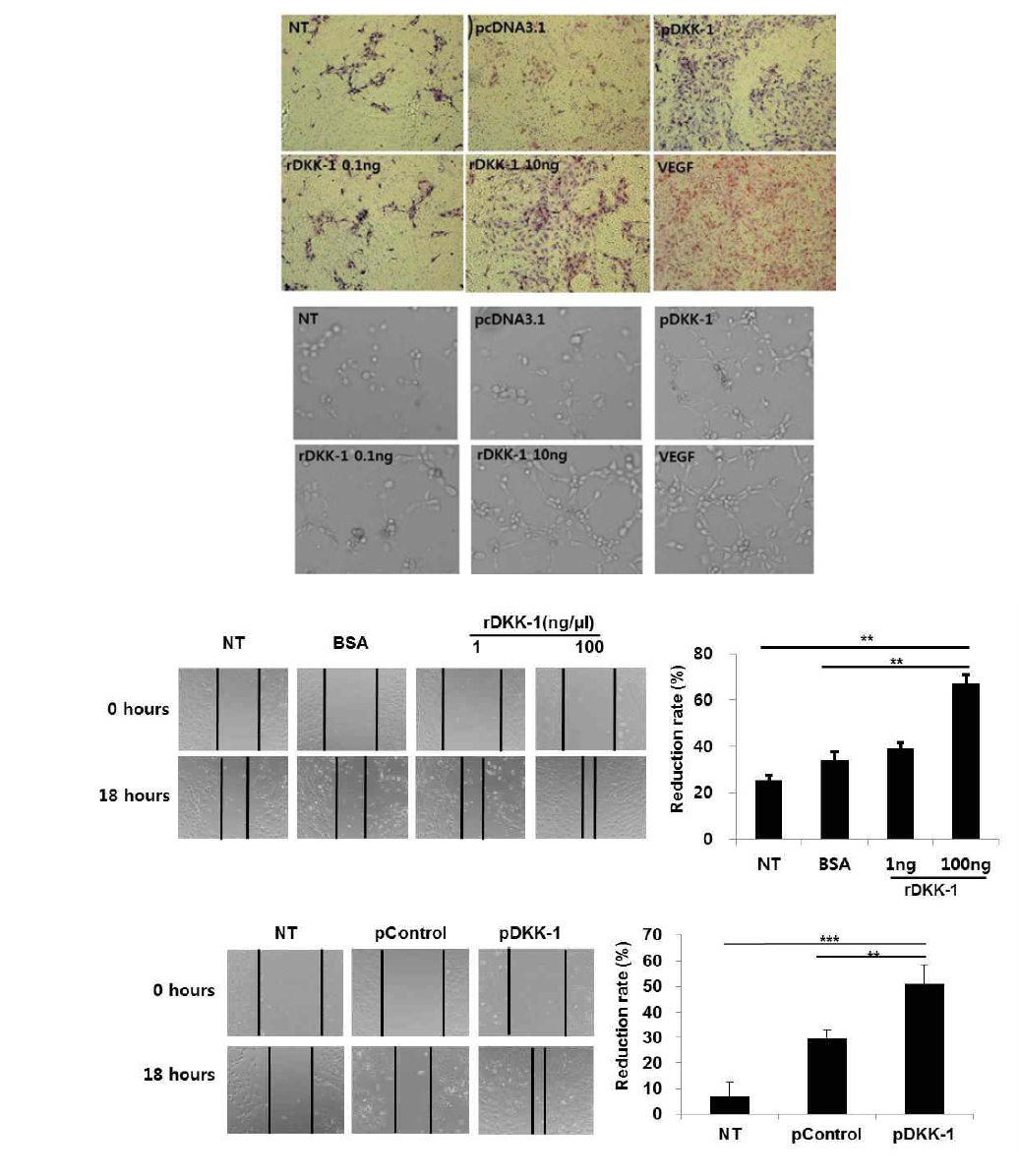 pDKK-1과 rDKK-1의 angiogenic potential