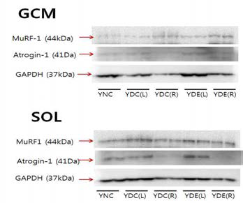 청년쥐. MuRF-1과 Atrogin-1의 expression