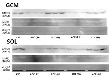 노화쥐. MuRF-1과 Atrogin-1의 expression