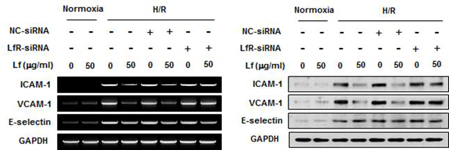 저산소 상태에서 LfR-siRNA를 활용한 Lf의 세포부착 분자 발현 조절 변화 양상