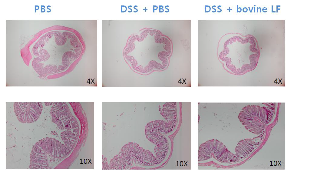 장 질환 모델에서 bLf 섭취에 따른 장 조직의 파괴 정도 비교