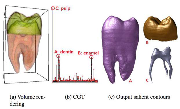 치아CT에서 CGT 생성을 통해 salient contour (A: dentin, B: enamel, C: pulp)를 자동으로 추출