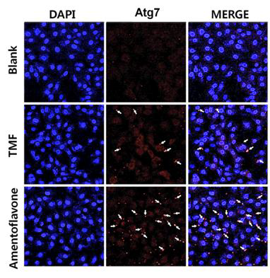 Laser confocal images of Atg7 immunoflurescence-stained A549 cells.