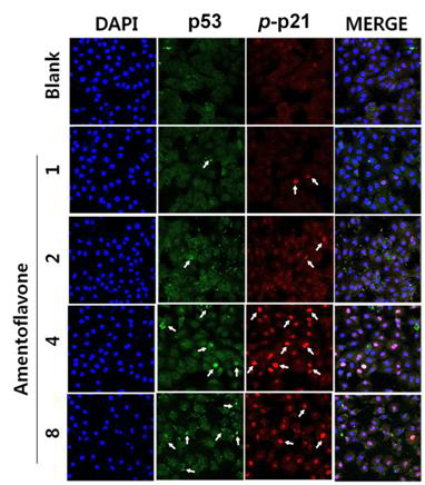 Laser confocal images of p53 (FITC) and p-p21(CY3) immunoflurescence-stained A549 cells.