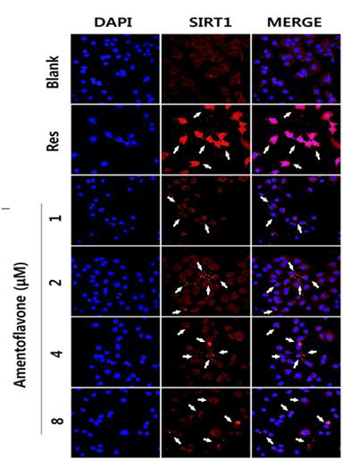 Laser confocal images of SIRT1 (CY3) immunoflurescence-stained A549 cells.