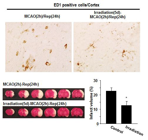 선행연구: 방사선조사에 의한 말초염증세포제거 시 허혈에 의한 뇌 손상 억제