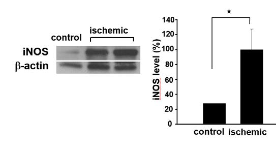 허혈조건에서 M1 marker(iNOS) 발현증가