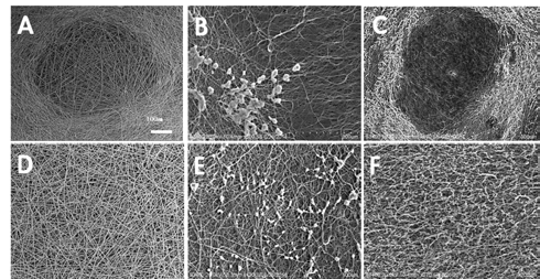 1X 처리된 PCL 막의 SEM image