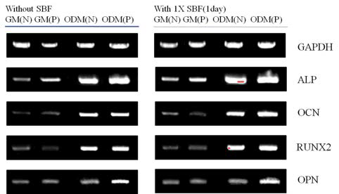 RT-PCR analysis to detect the expression of bone markers in ASCs