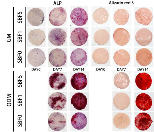 ALP / Alizarin Red S 염색법을 통한 골 유사 성분의 정도에 따른 지방유래 줄기세포의 골 분화능 비교