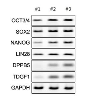수립된 세포주의 RT-PCR 만능성 조사