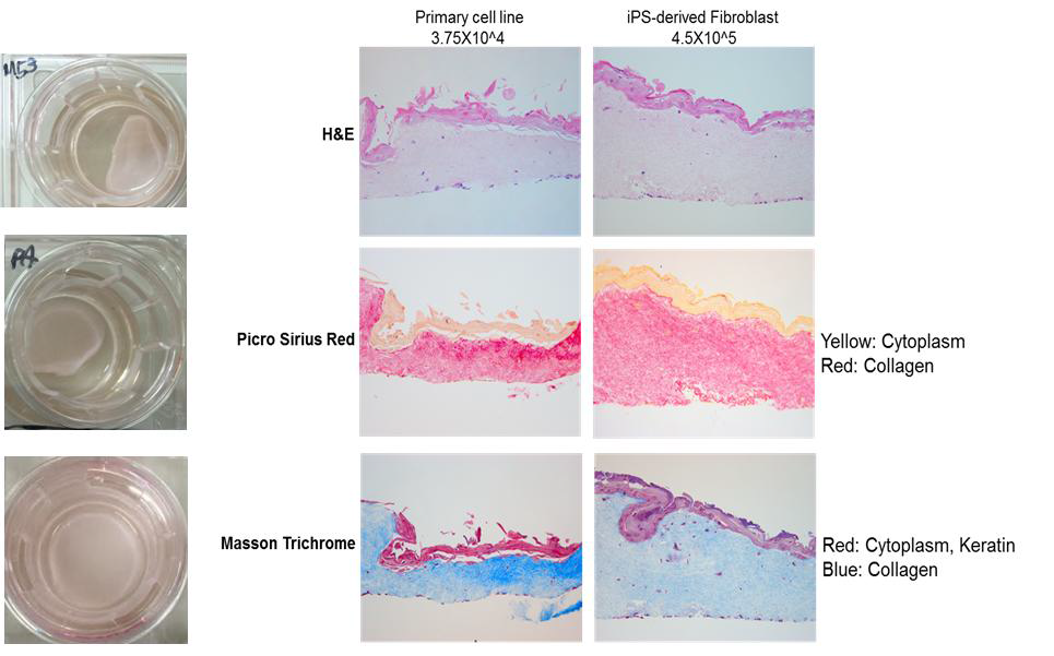 구현된 3D skin organoid. SSc에서 유도된 skin organoid는 dermis area가 더 두껍고 extracellular matrix가 더 많이 생산됨을 확인. SSc(systemc sclerosis),