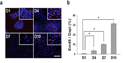 헌팅턴병 in vitro 모델 확립