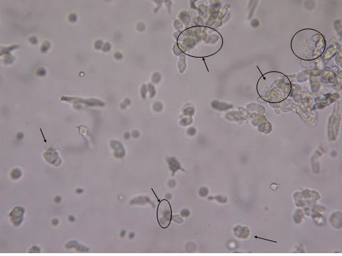 Isolation of trachea epithelial cells (upper), change of intra cellular calcium by confocal microscope(middle) and quantification of several selected epithelial cells(lower).