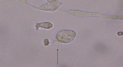 Isolation of single trachea epithelial cells (upper), change of intra cellular calcium by confocal microscope(middle) and quantification of several selected epithelial cells(lower).